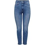 Only Jeans 15283925