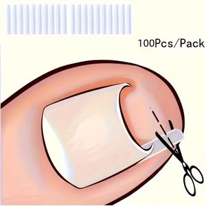 100 stuks ingegroeide nagelkit van voetgereedschap en voetgereedschap