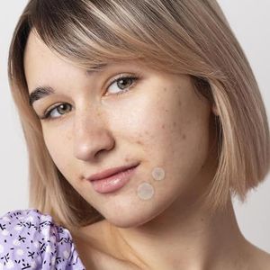 30 stuks puistjespleisters, onzichtbare patches voor acne, hydrocolloïde met natuurlijke extracten, tegen onzuiverheden van de huid, dermatologisch getest