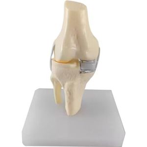 LKYLVEE Model met één condylus kniegewricht - Model voor totale knievervanging - Anatomisch leermiddel voor voorlichting en studie van patiënten,B,15cm