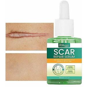 Littekenverwijderingsgel - Olie voor Striae Reparatie en Littekenverwijdering | 30ml Oil Zwangerschap Huidverzorgingsolie voor Zwangerschap Striae Brandwonden Litteken Zankie