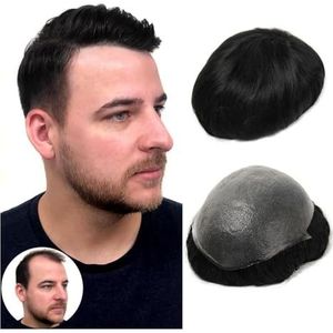 Heren toupet Super dunne huid heren toupetje 0,06 mm ultra dunne huid haarsysteem for mannen menselijk haar zwart bruin blond grijs Pruiken(Meidium Blode,8x10)