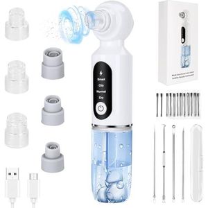 UCAMP Mee-eterverwijderaar en poriënreiniger,mee eters verwijderen,vacuum verwijderaar,premium blackhead remover,oplaadbare comedonextractorkit voor acne en whitehead-verwijdering voor dames en heren