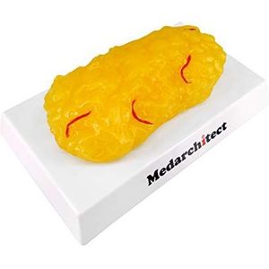 Authentieke replica van menselijk lichaamsvet met rode aderen - 1 pond, fit blijven en gewichtsverlies motivatie en herinnering, demonstratiemodel voor menselijk vetweefsel voor voedingsdeskundigen