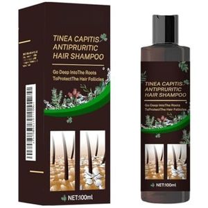 Anti-haaruitval Shampoo - Oliecontrole En Anti-roos, Jeukverlichting, Verfrissende Formule, Voedt Het Haar, Geschikt For Alle Haartypen(1PCS)