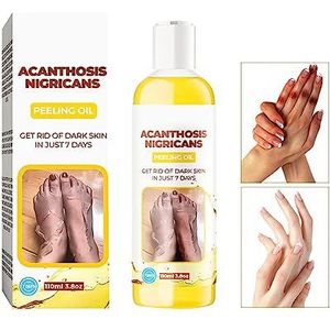 Fengyang® Acanthosis Nigricans Peeling-olie, gele peeling-olie voor donkere huid whitening