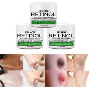 Skin Whitening Cream for Dark Skin,Skin Lightening Cream-Underarm Whitening Cream,Underarm Armpit Whitening Cream,Armpit Whitening Cream,Skin Lightening Cream,Underarm Whitening Cream (3pcs,50ML)