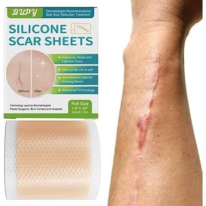 Siliconentape voor littekens | Herbruikbare stickervellen voor reparatie van huidlittekens - Lichaamsverzorgingsproducten, littekentape voor thuis, zakenreizen, werken, reizen, Pologmase