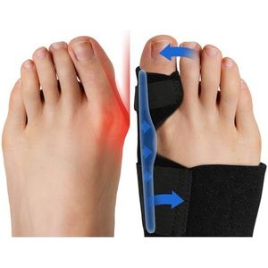 Fittest Pro Bunion Corrector (2 stuks) FSA of HSA komt in aanmerking, orthopedische eeltknobbelspalk, pijnverlichting van grote teenkappers, niet-chirurgische hallux valgus-correctie