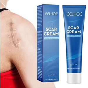 Lichaamslittekengel - Burn Repair Balm huid,0,5 fl. Oz Scar Gel voor keloïden en hypertrofische littekens, vermindert verschijning van blauwe plekken, hydraterenNiktule