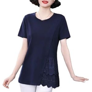 Dames zomer mode kant split korte mouw T-shirt vrouwen mode casual effen pullover blouses tops, koningsblauw, L