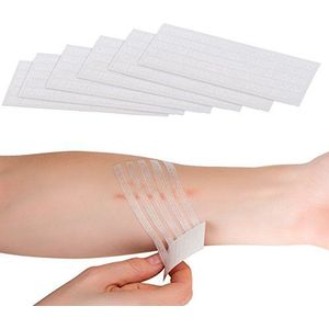newgen medicals Pleisters: 30 stuks medische wondnaadstrips, pleisters, 100 x 6 mm (pleisters die wonden bij elkaar houden, EHBO-kit, outdoor onderweg)