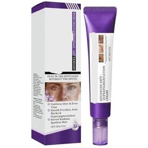 Retinol Spot Care Cream - Zachte Gezichtscrème For Een Egale Teint, Verheldering En Dagelijkse Hydratatie, Speciaal Ontwikkeld Vlekjesproblemen(1PCs)