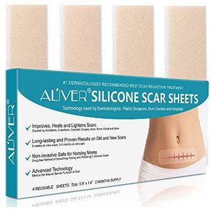 Siliconen littekenverwijderingspleisters, snel en effectief, verwijdert littekens door keizersnede, acne, chirurgie, brandwonden enz., herbruikbare littekenstrips [15 x 4 cm], 4 stuks (voor 2 maanden)
