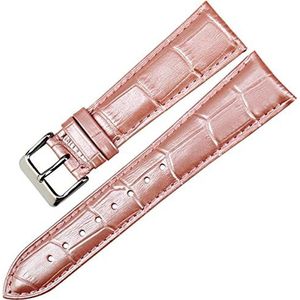 leer vervangingsbanden, horloges Polsband for mannen en vrouwen, wit 14 16 18 20 22 mm horlogeband lederen horlogeband kast horlogeband (Size : Roze)