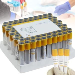 100 stuks vacuümbloedafnamebuizen, 3 ml/5 ml/10 ml wegwerpbare glazen bloedbuizen, scheidingsgel + coagulatiebuis, voor serumafscheiding, PRP-preparatie, met gele dop,10ml