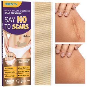 Siliconen littekenverwijderingsblad,Ademende zelfklevende littekentaperol - Herbruikbare littekenstrips voor het verminderen van littekens, littekenverzorgingsbenodigdheden voor brandwonden,