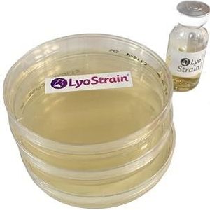 PETRI-platen met AGAR TSA-microbiologie voor de groei van bacteriën (20)