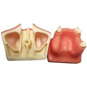 LKYLVEE Maxillaire sinuslift oefenmodel - Tandheelkundig implantaat oefenmodel - Geweldig tandheelkundig trainingsmateriaal voor het oefenen van tandheelkundige implantaten,Flesh,8cm