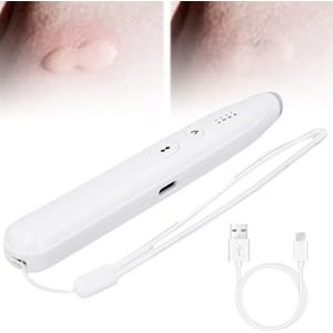 Muggenbeet Warmtepen - 4 Standen Temperatuur, Insectensteek & Beet Verlichtingsstick, After Bite Care Anti-Jeuk Pen, Voor Muggenbeten, Voor Jeuk, Zwelling