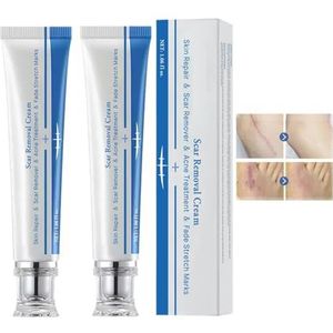 Littekenverwijderingscrème 2 stuks, huidherstelgel voor oude en nieuwe littekens, littekenbehandelingscrème voor gezicht, chirurgische acnelittekens, C-sectie, brandwonden, striae