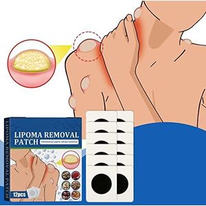 dhcprj Lipoma Removal Patches,Snelle En Effectieve Natuurlijke Pure Kruiden Lipoom Knobbels Verwijdering Patches Voor Get Rid Van Uw Vette Lipoom Knobbels,Lipoma Removal Patches Voor Lichaam