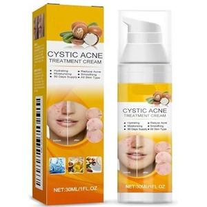 Gezichtsserum For Huidverzorging - Vermindert Vlekjes, Minimaliseert Poriën, Reguleert Olie, Is Mild En Hydraterend, Geschikt For Acne Op Gezicht Lichaam(2PCS)