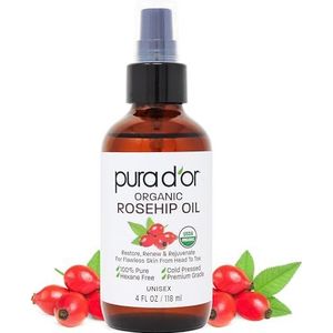 PURA D'OR Rosehip Seed Oil 100% Pure & USDA Organic For Face, Hair, Skin & Nails, 4 Fluid Ounce by PURA D'OR