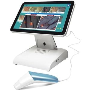 Intelligente hoofdhuidanalysemachine, framesnelheid: 640x480, 30 frames/responstijd: 3,3 V/lux-sec/sonde, vergroting: 200 keer, for schoonheidssalons