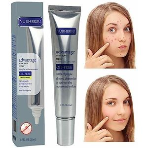 Crème voor het verwijderen van puistjes | Smetverwijderaar vette huid - 20 ml voedenen kalmerengezichtscrème voor puistjes, rood ogenhuid na een onzuiverheid