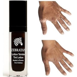 Vitiligo Make-up op maat gemaakt – 7 ml diepbruin – zelfbruiningslotion – camouflageplaten