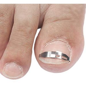Supvox Ingegroeide roestvrijstalen teennagel-pedicure-gereedschap richt-correctieclip, gebogen klem teennagels dik paronychie-correctiegereedschap