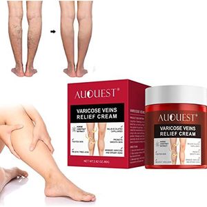 Varicose Vein & Soothing Leg Cream, Relieve Tired Legs Dilated Vasculitis Phlebitis Spider Pain Relief Ointment Body Care 80g