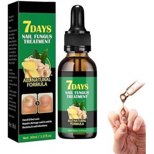 Gember Nail Behandeling, Gember Cuticle Oil voor Nagels,7 dagen Nagelbehandeling, Gember Nail Growth Serum, Nail Nutriënt Olie voor Beschadigde Nagels Dunne Nagels Cuticula Reparatie