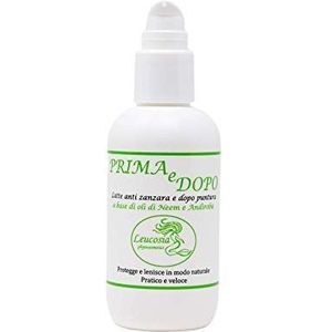 Voor en na - Anti-muggen- en nabeetmelk - 75 ml - Beschermt tegen muggen en kalmeert de jeuk van eerdere beten - Uitstekend geschikt voor de tere huid