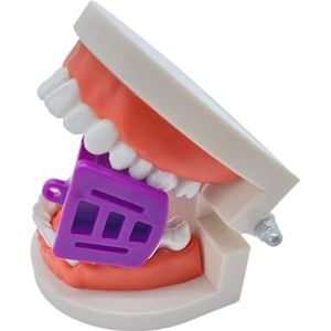 Siliconen mondopener mondsteun 20 stuks grote middelgrote kleine drie kleuren occlusale pads (paars)