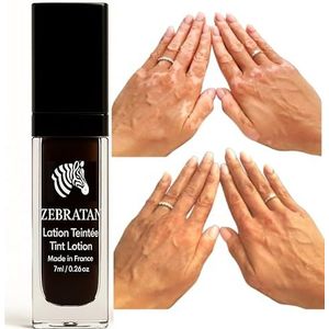 Vitiligo Make-up op maat gemaakt – 7 ml beige bruin – zelfbruiningslotion – camouflageplaten