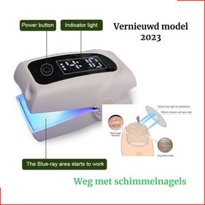 Nagel Schimmel Kalknagel laserapparaat. VERNIEUWD Model. zelf behandeling, veilig, effectief, snel en pijnloos, koude laser behandeling voor thuisgebruik, voor tenen en vingers. Met tijd display en oplaadbaar.
