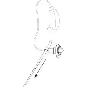 Widex - Anchor for RIC - Stabiliteitshulpmiddel - 20 stuks