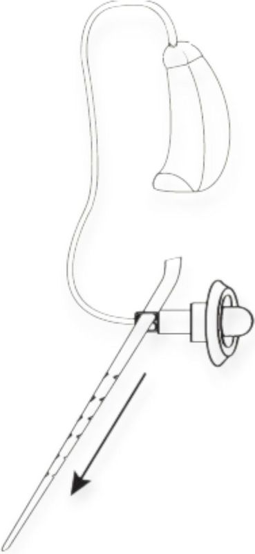 Widex - Anchor for RIC - Stabiliteitshulpmiddel - 20 stuks