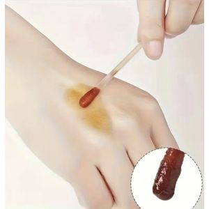 Wondverzorging Set – 5 Alcohol Wattenstaafjes & 5 Jodium Wattenstaafjes – Steriele Desinfectie Applicators voor EHBO en Ontsmetting