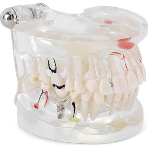 Allecto Plus - Transparant tandmodel voor tandheelkundig onderwijs en studie, volwassen model met verwijderbare tanden