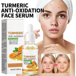 Zeer effectieve kurkuma olie serum voor anti aging, verminderd huidveroudering, vlekken huiduitslag acne met natuurlijke ingredienten