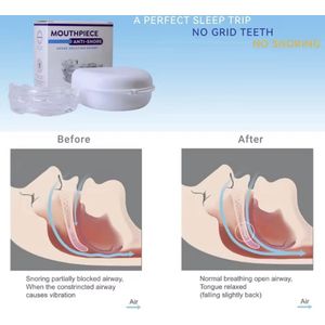 Anti Snurk - Verstelbaar Mondstuk - Tegen Snurken en Tandenknarsen - Comfortabele Mondbeschermer met Opbergbox - BPA Vrij