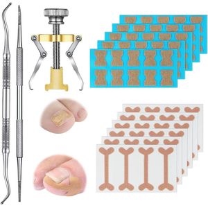Gereedschapsset voor het behandelen van ingegroeide teennagels - Inclusief elastische patch, gebogen corrector, correctiestickers, teennagelvijl en lifter nagelbeugel