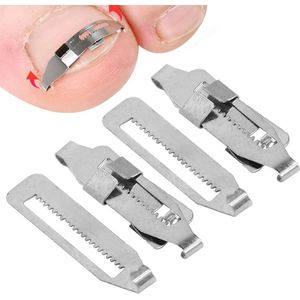 Ingegroeide Teennagel Corrector 2 STUKS Rvs - Paronychia Correctie Tool - Teennagel Correctie Kit .
