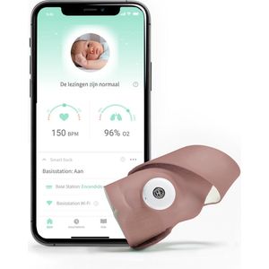 Owlet Smart Sock 3 - Babymonitor met Zuurstof- & Hartslagmeter (0-18 maanden) - Roze