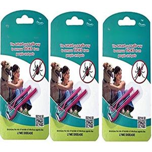 Lexium Tekentang - Tekenpincet - Tekenverwijderaar - Tekenpincet mens - Teek pincet - Tekenlasso - Tekenhaak - Tekentang voor honden en katten