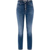 Guess Jeans 1981 Blootgestelde Knoop - Streetwear - Vrouwen
