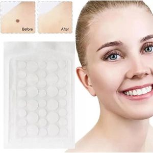 Puisten Verwijderraar - Puisten Pleister - Acne Pleister - Acne Sticker - Pimple Patch - Acne Patch - Puistjes Verwijderen - 108 stuks